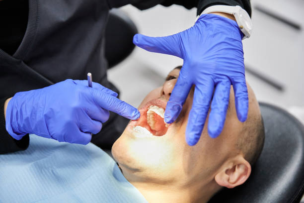 Best Urgent Tooth Repair  in Lancaster, OH